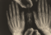 bgfch.png